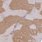 Immunohistochemical staining of human skeletal muscle shows moderate cytoplasmic positivity in myocytes.