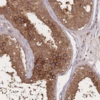 Immunohistochemical staining of human testis shows strong cytoplasmic positivity in cells in seminiferous ducts.