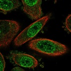 Immunofluorescent staining of human cell line PC-3 shows localization to nuclear membrane & cytosol.