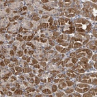 Anti-HRASLS Antibody