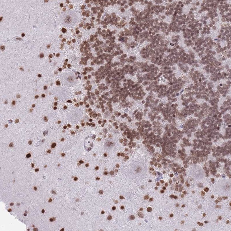 Anti-KIAA1644 Antibody