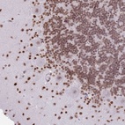 Anti-KIAA1644 Antibody