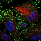 Immunofluorescent staining of human cell line U-251 MG shows localization to focal adhesion sites.