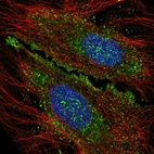 Immunofluorescent staining of human cell line HeLa shows localization to cytosol & vesicles.