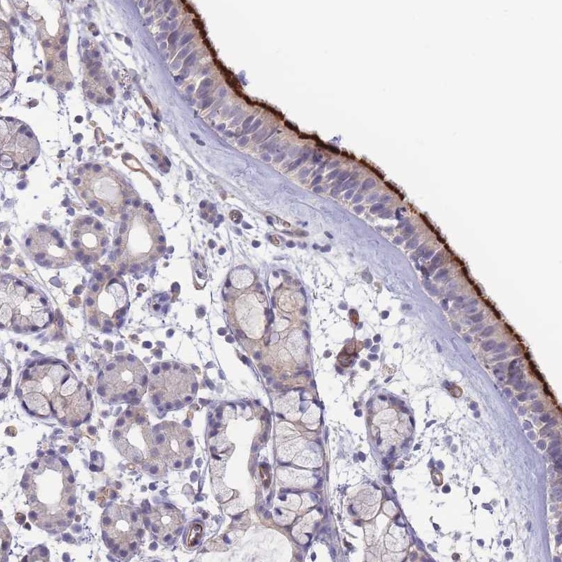 Anti-NDUFAF5 Antibody