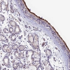 Anti-NDUFAF5 Antibody