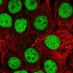 Immunofluorescent staining of human cell line MCF7 shows localization to nucleoplasm.