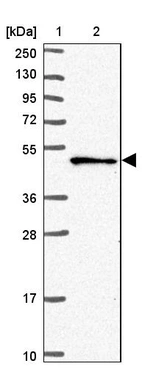 Lane 1: Marker [kDa] 250, 130, 95, 72, 55, 36, 28, 17, 10_br/_Lane 2: Human cell line RT-4