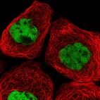 Immunofluorescent staining of human cell line A-431 shows localization to nucleoplasm.