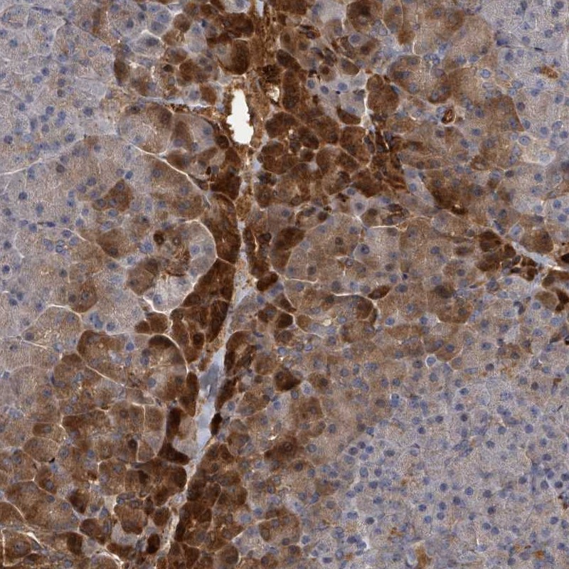 Anti-TRPC4AP Antibody