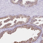 Anti-CYP19A1 Antibody