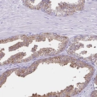 Immunohistochemical staining of human prostate shows low expression as expected.