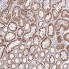 Immunohistochemical staining of human kidney shows moderate granular cytoplasmic positivity in cells in tubules.