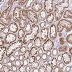 Immunohistochemical staining of human kidney shows moderate granular cytoplasmic positivity in cells in tubules.