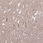 Immunohistochemical staining of human cerebral cortex shows moderate granular cytoplasmic positivity in neurons.