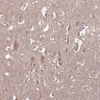 Immunohistochemical staining of human cerebral cortex shows moderate granular cytoplasmic positivity in neurons.