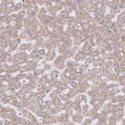 Immunohistochemical staining of human liver shows weak granular cytoplasmic positivity in hepatocytes.