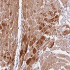 Immunohistochemical staining of human heart muscle shows high expression.