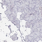 Immunohistochemical staining of human salivary gland shows low expression as expected.