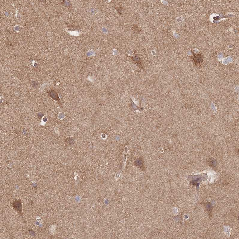 Anti-RASSF2 Antibody