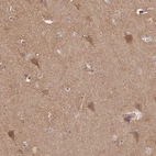 Anti-RASSF2 Antibody