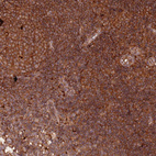 Immunohistochemical staining of human lymph node shows strong cytoplasmic positivity in non-germinal center cells and germinal center cells.