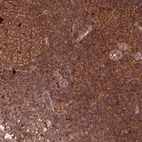 Immunohistochemical staining of human lymph node shows strong cytoplasmic positivity in non-germinal center cells and germinal center cells.