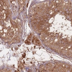 Immunohistochemical staining of human testis shows strong cytoplasmic positivity in cells in seminiferous ducts and Leydig cells.