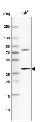 Western blot analysis in human cell line NB4.
