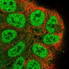 Immunofluorescent staining of human cell line RT4 shows localization to nucleoplasm & cytosol.