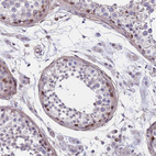 Immunohistochemical staining of human testis shows strong nuclear positivity in subset of cells in seminiferous ducts.