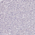 Immunohistochemical staining of human liver shows no positivity in hepatocytes as expected.