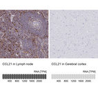 Anti-CCL21 Antibody