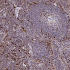 Immunohistochemical staining of human lymph node shows strong cytoplasmic positivity in lymphoid cells.