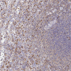 Anti-CCL21 Antibody