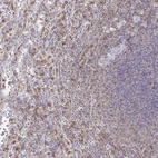Immunohistochemical staining of human spleen shows moderate cytoplasmic positivity in cells in red pulp.