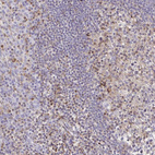 Anti-CCL21 Antibody