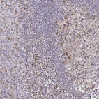 Immunohistochemical staining of human tonsil shows moderate to strong cytoplasmic positivity in germinal center cells.