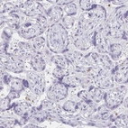 Immunohistochemical staining of human placenta shows no cytoplasmic positivity in trophoblastic cells as expected.