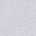 Immunohistochemical staining of human cerebral cortex shows no cytoplasmic positivity in neuronal cells as expected.