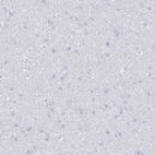 Immunohistochemical staining of human cerebral cortex shows no cytoplasmic positivity in neuronal cells as expected.