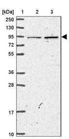 Lane 1: Marker [kDa] 250, 130, 95, 72, 55, 36, 28, 17, 10_br/_Lane 2: Human cell line RT-4_br/_Lane 3: Human cell line U-251MG sp