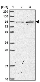 Lane 1: Marker [kDa] 250, 130, 95, 72, 55, 36, 28, 17, 10_br/_Lane 2: Human cell line RT-4_br/_Lane 3: Human cell line U-251MG sp