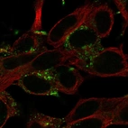 Immunofluorescent staining of human cell line SH-SY5Y shows localization to vesicles.