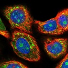 Immunofluorescent staining of human cell line MCF7 shows localization to nucleoli & cytosol.