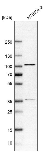 Anti-ZNF281 Antibody