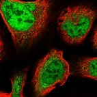 Immunofluorescent staining of human cell line U-2 OS shows localization to nucleoplasm.