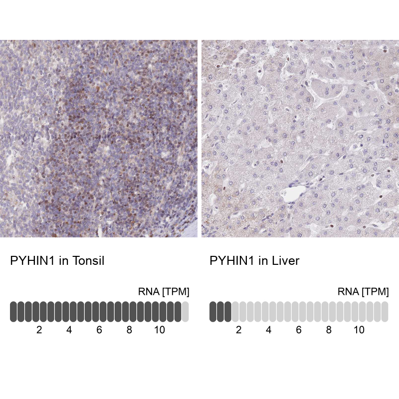 Anti-PYHIN1 Antibody