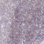 Immunohistochemical staining of human tonsil shows moderate nuclear positivity in non-germinal center cells.