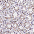 Immunohistochemical staining of human rectum shows moderate cytoplasmic/ nuclear positivity in lymphoid cells.
